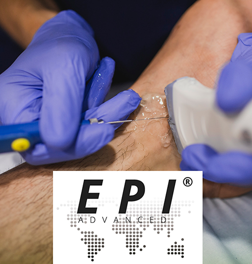epi